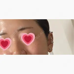 ギャラリークリニック 横浜院口コミ