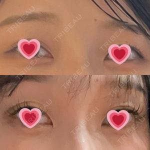 千葉美容外科アイビークリニック口コミ