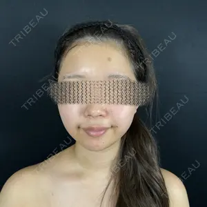 藤・ナチュレ美容クリニック 銀座院口コミ