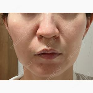 石倉クリニック 水戸院口コミ