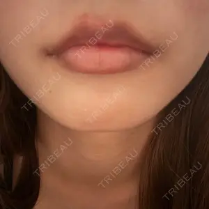 HAAB×DREAM BEAUTY CLINIC 大阪梅田院口コミ
