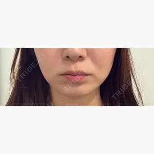 FACE SKIN CLINIC 池袋口コミ