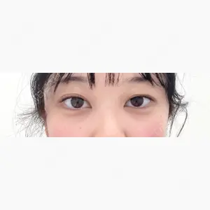 東京シンデレラ美容外科 池袋院口コミ