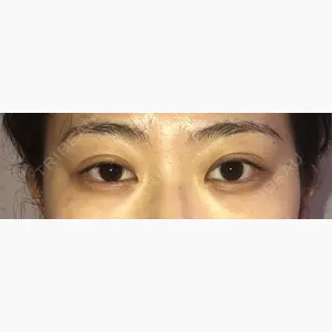 ボナイ整形外科口コミ