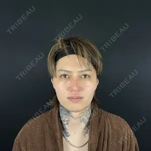 藤・ナチュレ美容クリニック 銀座院口コミ