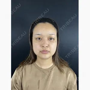藤・ナチュレ美容クリニック 銀座院口コミ