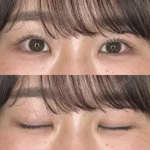 湘南美容クリニック 池袋東口院口コミ