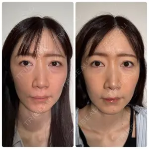 神戸美容外科 ネビュラクリニック口コミ