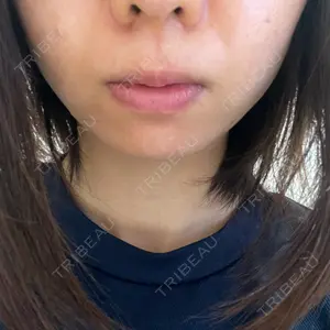 愛知春日井美容外科ネビュラクリニック口コミ