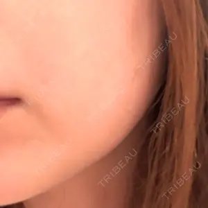 HAAB×DREAM BEAUTY CLINIC 大阪梅田院口コミ