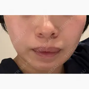 品川スキンクリニック銀座院口コミ