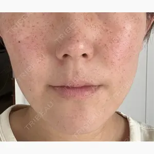 アデル美容クリニック口コミ