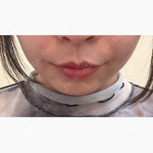 eクリニック 広島院口コミ