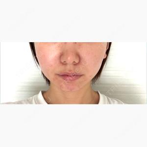 ルラ美容クリニック 札幌本院口コミ