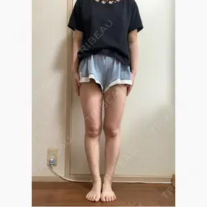 湘南美容クリニック 池袋東口院口コミ