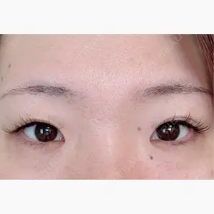 アリエル美容クリニック 水戸院口コミ