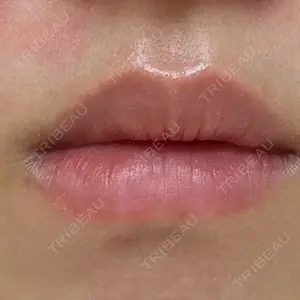 Lūna Beauty Clinic口コミ