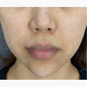 NARU SKIN Beauty Clinic口コミ