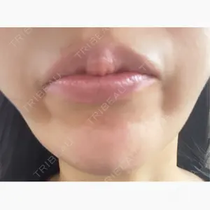 湘南美容クリニック 金山院口コミ