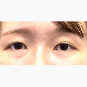 ネビュラクリニック 広島院口コミ