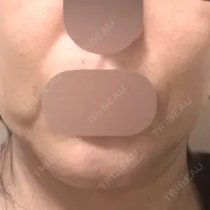 DAILY SKIN CLINIC 新宿院口コミ