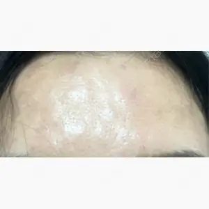 FACE SKIN CLINIC 池袋口コミ