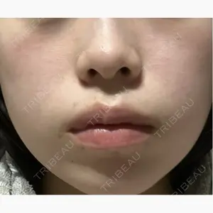 TCB東京中央美容外科 宇都宮院口コミ