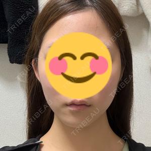 オアシス美容外科口コミ