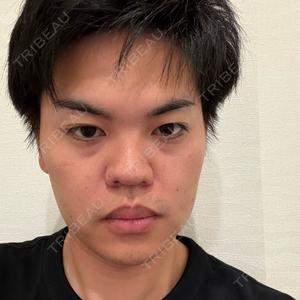 BOSSクリニック上野口コミ