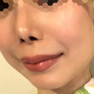 Natural Skin Clinic 自由ヶ丘院口コミ