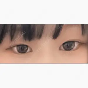 R Beauty CLINIC 大阪院口コミ