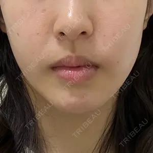 HAAB CLINIC 池袋院口コミ