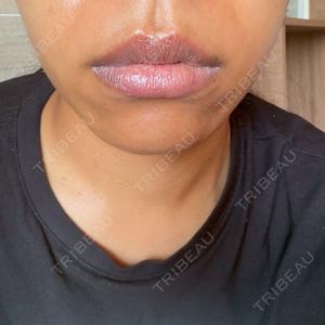 Tokyo Tensei Clinic 新宿院口コミ