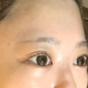 札幌美容外科ネビュラクリニック口コミ