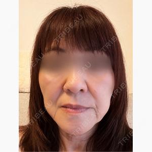 eクリニック 広島院口コミ