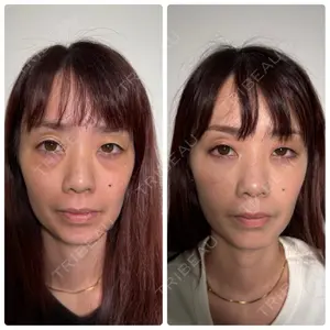 神戸美容外科 ネビュラクリニック口コミ