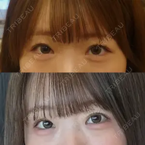 銀座みゆき通り美容外科 大阪梅田院口コミ