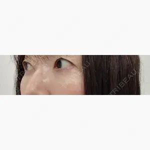 TCB東京中央美容外科 岡山院口コミ
