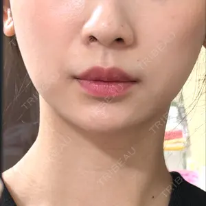 藤・ナチュレ美容クリニック 銀座院口コミ