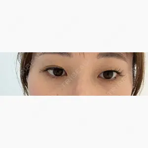 東京シンデレラ美容外科 大宮院口コミ