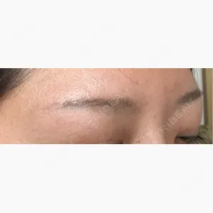 Mirelle Clinic 大阪院口コミ