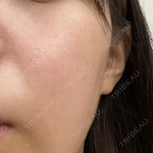 赤羽ひだまりクリニック皮膚科・美容外科口コミ
