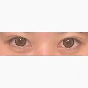 東京シンデレラ美容外科 大宮院口コミ