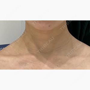PRO CLINIC プロクリニック 銀座院口コミ