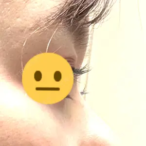 ASTRA BEAUTY CLINIC口コミ
