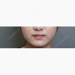 アリエル美容クリニック 大宮院口コミ