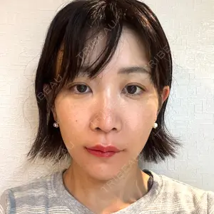 インクリニック口コミ