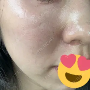 ZX-CLINIC 梅田院口コミ