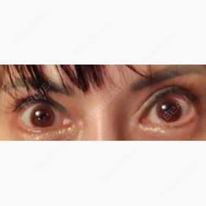 エターナル美容クリニック口コミ
