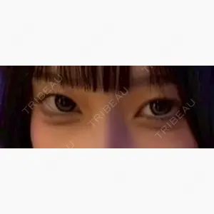 東京シンデレラ美容外科 大宮院口コミ